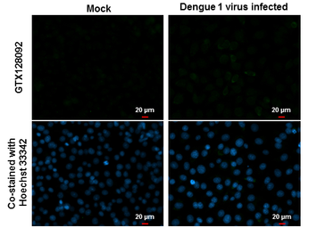 Anti-Dengue virus prM protein antibody used in Immunocytochemistry/ Immunofluorescence (ICC/IF). GTX128092
