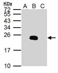 Anti-Dengue virus prM protein antibody used in Western Blot (WB). GTX128093
