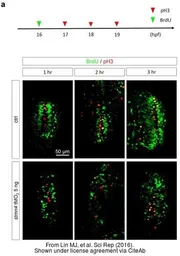 Anti-Histone H3S10ph (phospho Ser10) antibody used in Immunocytochemistry/ Immunofluorescence (ICC/IF). GTX128116