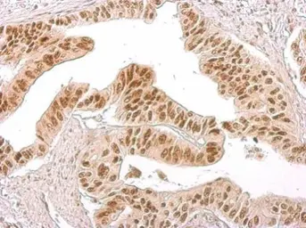 Anti-Histone H3S10ph (phospho Ser10) antibody used in IHC (Paraffin sections) (IHC-P). GTX128116