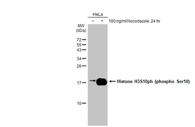 Anti-Histone H3S10ph (phospho Ser10) antibody used in Western Blot (WB). GTX128116