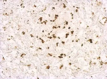 Anti-Porcine circovirus type 2 / PCV2 Capsid antibody used in IHC (Paraffin sections) (IHC-P). GTX128120