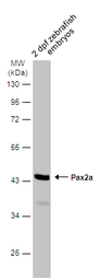 Anti-Pax2a antibody used in Western Blot (WB). GTX128127