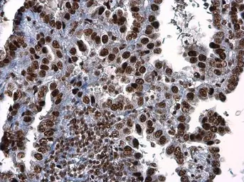 Anti-ATR (phospho Thr1989) antibody used in IHC (Paraffin sections) (IHC-P). GTX128145