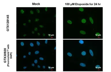 Anti-ATR (phospho Thr1989) antibody used in Immunocytochemistry/ Immunofluorescence (ICC/IF). GTX128145