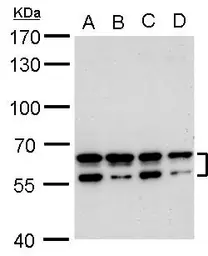 Anti-CDYL2 antibody used in Western Blot (WB). GTX128239