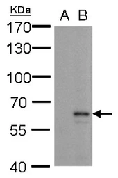 Anti-MMP24 antibody used in Western Blot (WB). GTX128246