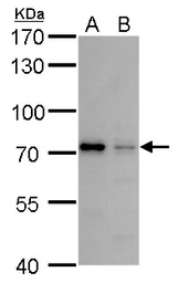 Anti-MMP24 antibody used in Western Blot (WB). GTX128246