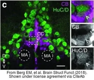 Anti-Elavl3+4 antibody used in IHC (Frozen sections) (IHC-Fr). GTX128365