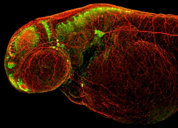 Anti-Elavl3+4 antibody used in IHC (Whole mount) (IHC-Wm). GTX128365