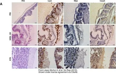 Anti-Mpx antibody used in  (). GTX128379