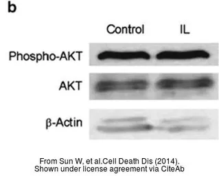 Anti-AKT (phospho Ser473) antibody used in Western Blot (WB). GTX128414