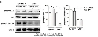 Anti-AKT (phospho Ser473) antibody used in Western Blot (WB). GTX128414