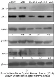 Anti-AKT (phospho Ser473) antibody used in Western Blot (WB). GTX128414