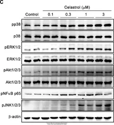 Anti-AKT (phospho Ser473) antibody used in Western Blot (WB). GTX128414