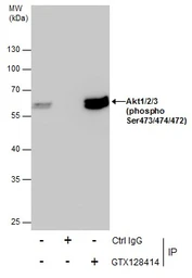 Anti-AKT (phospho Ser473) antibody used in Immunoprecipitation (IP). GTX128414