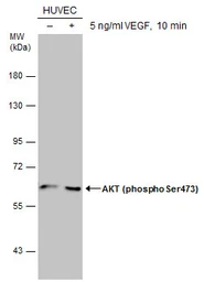 Anti-AKT (phospho Ser473) antibody used in Western Blot (WB). GTX128414