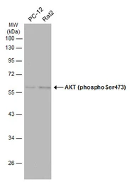 Anti-AKT (phospho Ser473) antibody used in Western Blot (WB). GTX128414