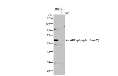 Anti-AKT (phospho Ser473) antibody used in Western Blot (WB). GTX128414