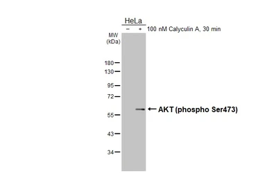 Anti-AKT (phospho Ser473) antibody used in Western Blot (WB). GTX128414