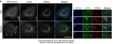 Anti-ATG9A antibody used in Immunocytochemistry/ Immunofluorescence (ICC/IF). GTX128427