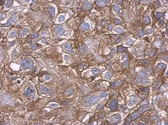 Anti-Carbonic Anhydrase IX antibody used in IHC (Paraffin sections) (IHC-P). GTX128428