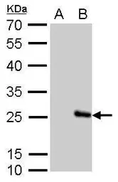 Anti-Influenza B virus M (matrix protein) antibody used in Western Blot (WB). GTX128536