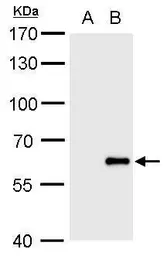 Anti-Influenza B virus antibody used in Western Blot (WB). GTX128544
