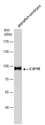 Anti-Csf1r antibody used in Western Blot (WB). GTX128677