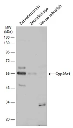 Anti-Cyp26a1 antibody used in Western Blot (WB). GTX128730