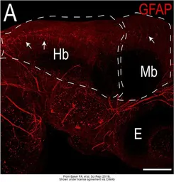 Anti-Gfap antibody used in  (). GTX128741