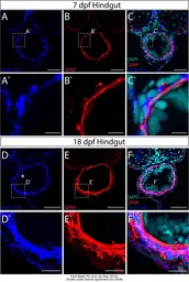 Anti-Gfap antibody used in  (). GTX128741