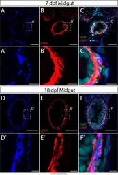 Anti-Gfap antibody used in  (). GTX128741