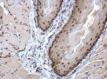 Anti-HIF1 beta antibody used in IHC (Paraffin sections) (IHC-P). GTX128795