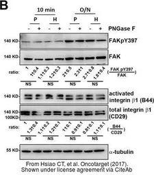 Anti-Integrin beta 1 / CD29 antibody used in Western Blot (WB). GTX128839