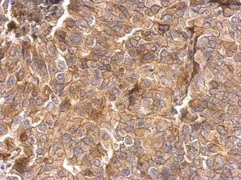 Anti-Integrin beta 1 / CD29 antibody used in IHC (Paraffin sections) (IHC-P). GTX128839