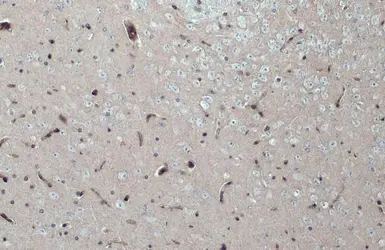 Anti-Integrin beta 1 / CD29 antibody used in IHC (Paraffin sections) (IHC-P). GTX128839