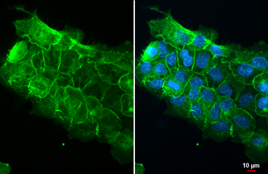 Anti-Integrin beta 1 / CD29 antibody used in Immunocytochemistry/ Immunofluorescence (ICC/IF). GTX128839