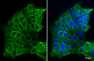 Anti-Integrin beta 1 / CD29 antibody used in Immunocytochemistry/ Immunofluorescence (ICC/IF). GTX128839