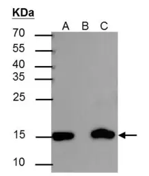 Anti-Histone H3K27ac (Acetyl Lys27) antibody used in Immunoprecipitation (IP). GTX128944