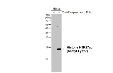 Anti-Histone H3K27ac (Acetyl Lys27) antibody used in Western Blot (WB). GTX128944