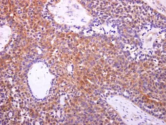 Anti-Aconitase 1 antibody used in IHC (Paraffin sections) (IHC-P). GTX128976