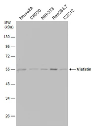 Anti-Visfatin antibody used in Western Blot (WB). GTX128980