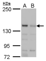 Anti-JARID2 antibody used in Western Blot (WB). GTX129019