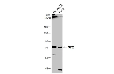 Anti-SP2 antibody used in Western Blot (WB). GTX129030