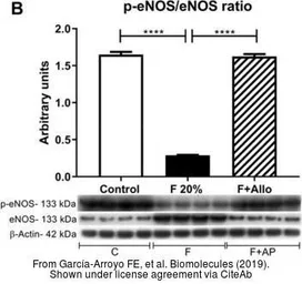 Anti-eNOS (phospho Ser1177) antibody used in Western Blot (WB). GTX129058