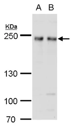 Anti-FIP200 antibody used in Western Blot (WB). GTX129093