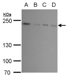 Anti-FIP200 antibody used in Western Blot (WB). GTX129094