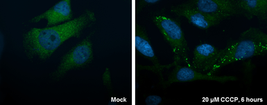 Anti-ATG16L1 antibody used in Immunocytochemistry/ Immunofluorescence (ICC/IF). GTX129098