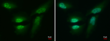 Anti-CDR2 antibody used in Immunocytochemistry/ Immunofluorescence (ICC/IF). GTX129122